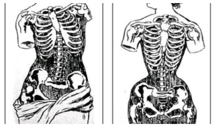 束腰带真的能瘦腰吗