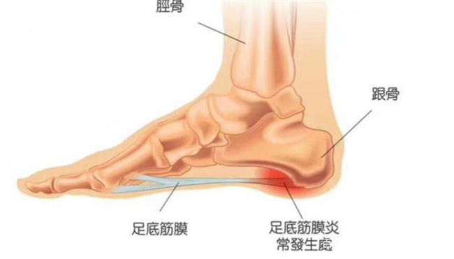 脚后跟痛的主要原因是什么 脚后跟痛要怎么治疗