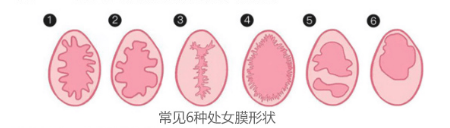 卫生棉条会破坏膜吗