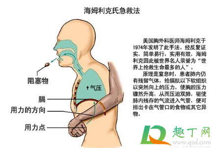 最基本的急救有哪几种