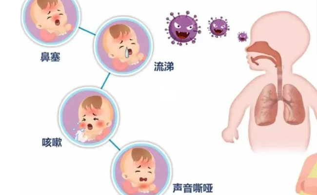 呼吸道合胞病毒感染患儿增加 平时应当关注孩子哪些方面？