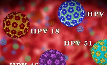 ​男童喉咙长菜花样肿块确诊感染HPV 小小年纪为何感染HPV？