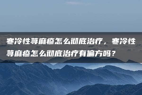 寒冷性荨麻疹怎么彻底治疗，寒冷性荨麻疹怎么彻底治疗有偏方吗？