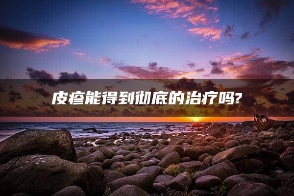 皮疹能得到彻底的治疗吗?