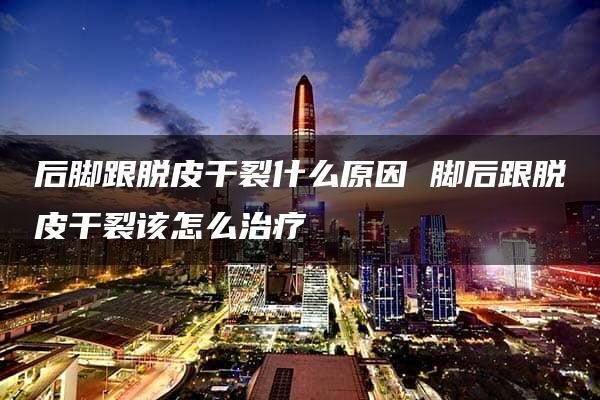 后脚跟脱皮干裂什么原因 脚后跟脱皮干裂该怎么治疗