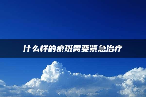 什么样的瘀斑需要紧急治疗