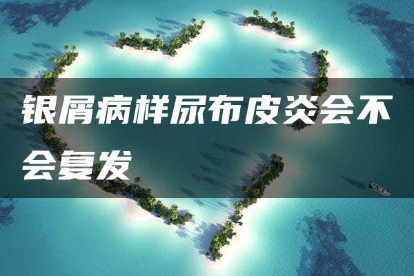 银屑病样尿布皮炎会不会复发