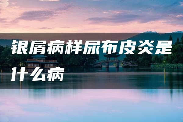 银屑病样尿布皮炎是什么病